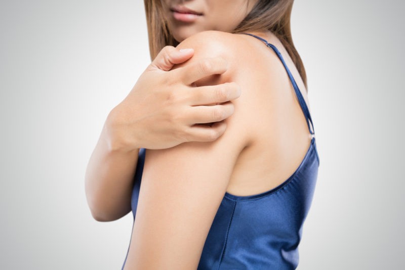 Kobieta z atopowym zapaleniem skóry (AZS) drapie się po ramieniu