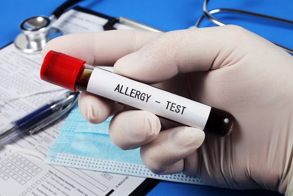 Testy alergiczne z krwi w zbliżeniu na ręce lekarza.